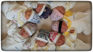 Nemocnice v Opavě zlepšuje komfort služeb pro nastávající maminky