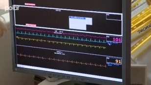 Monitorovací přístroj v Hornické nemocnici Karviná