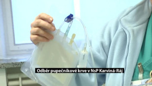 Odběr pupečníkové krve v NsP Karviná