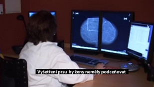 Preventivní vyšetření prsu by ženy neměly podceňovat