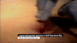 V karvinské nemocnici laparoskopicky operují 20 let