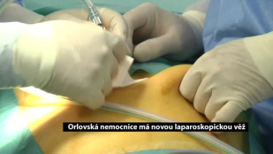 Orlovská nemocnice má novou laparoskopickou věž