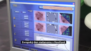 Evropský den melanomu se opět konal také v Havířově