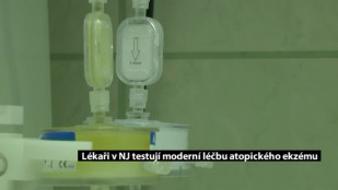 Lékaři v NJ testují moderní léčbu atopického ekzému