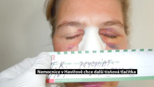 Nemocnice v Havířově chce další tísňová tlačítka