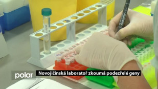 Novojičínská laboratoř zkoumá podezřelé geny