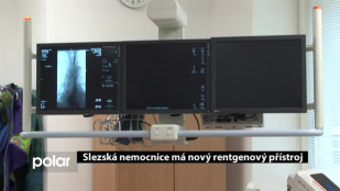 Slezská nemocnice má nový rentgenový přístroj