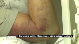 Karvinští policisté hledají muže, který pořezal taxikáře