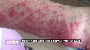 Zaměstnanci soukromého domova si stěžují na svrab