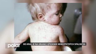 MS kraj je na hranici epidemie nebezpečných spalniček