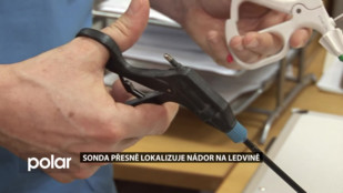 Sonda přesně lokalizuje nádor na ledvině