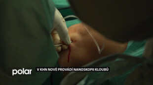 V Karvinské hornické nemocnici nově provádí nanoskopii kloubů v lokální anestezii
