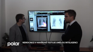 Nemocnice v Havířově testuje umělou inteligenci Carebot, která pomáhá číst rentgenové snímky