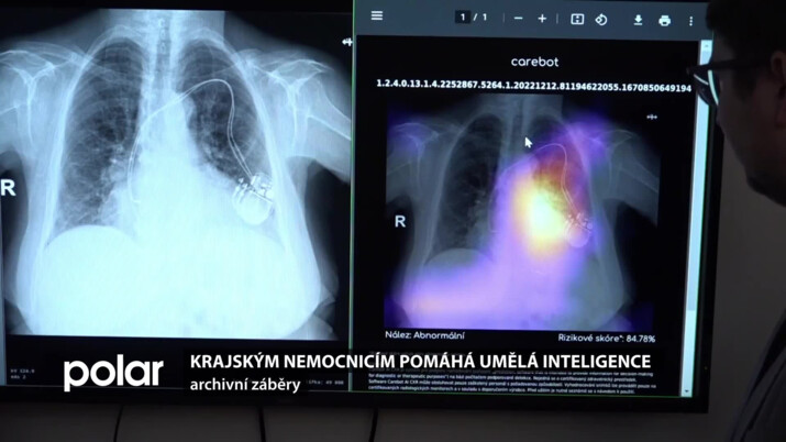 Krajským nemocnicím pomáhá umělá inteligence, možnosti se dále rozšiřují