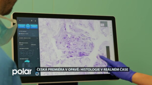 Moravskoslezská nemocnice Opava jako první v ČR zavádí do praxe takzvaný histologický skener