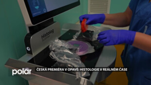 Opavská nemocnice jako první v ČR testuje unikátní skener