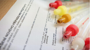 FN Ostrava se připojí k Evropskému týdnu testování na HIV, žloutenky a syfilis