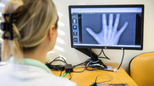 Ve FN Ostrava začala fungovat ambulance klinické antropologie