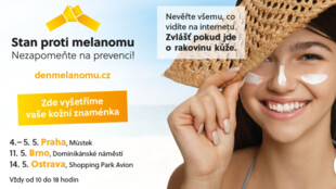 Stan proti melanomu dorazí do Ostravy 14. května