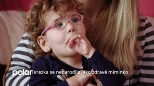 Startuje akce Šance pro Terezku. Dvouleté Terezce zajistí rehabilitace. Pomůže i Vaše stokoruna :-)