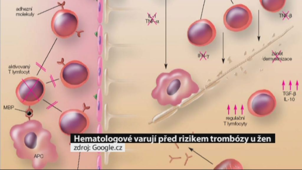 Regionální zprávy POLAR