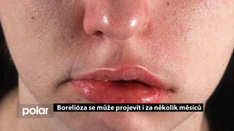 Regionální zprávy POLAR